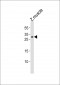 (DANRE) hoxb6a Antibody  (Center)